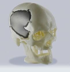 China O serviço de impressão profissional de SLS 3D personalizou as peças plásticas para produtos médicos fornecedor